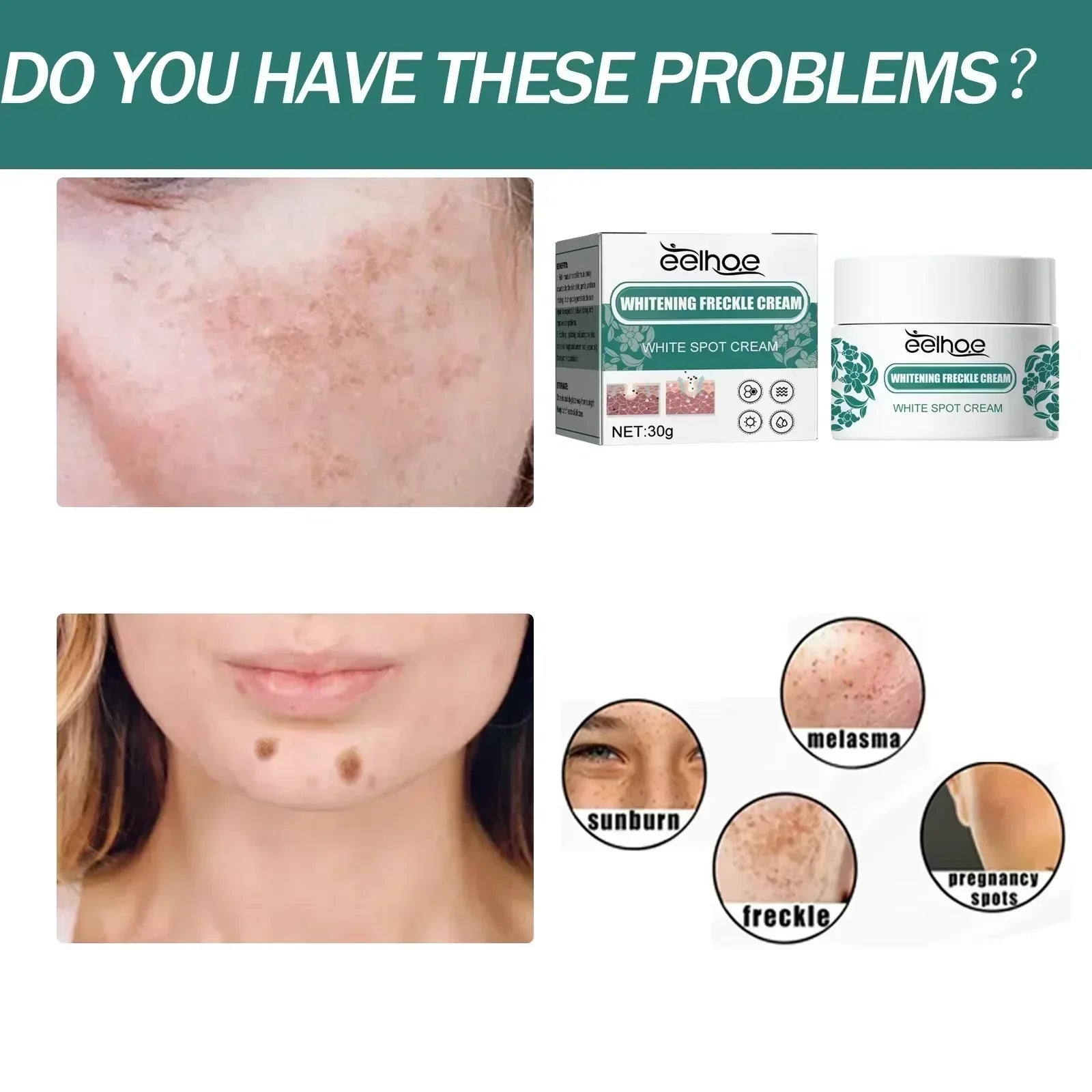 Eelhoe Niacinamide Brightening Cream
